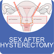 Sex After a Hysterectomy