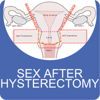 Sex After a Hysterectomy
